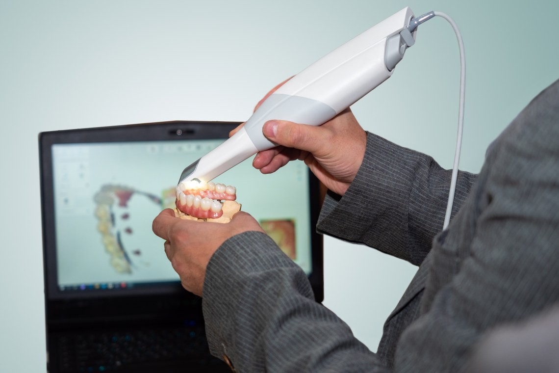 Intraoral Scanner CAD/CAM System